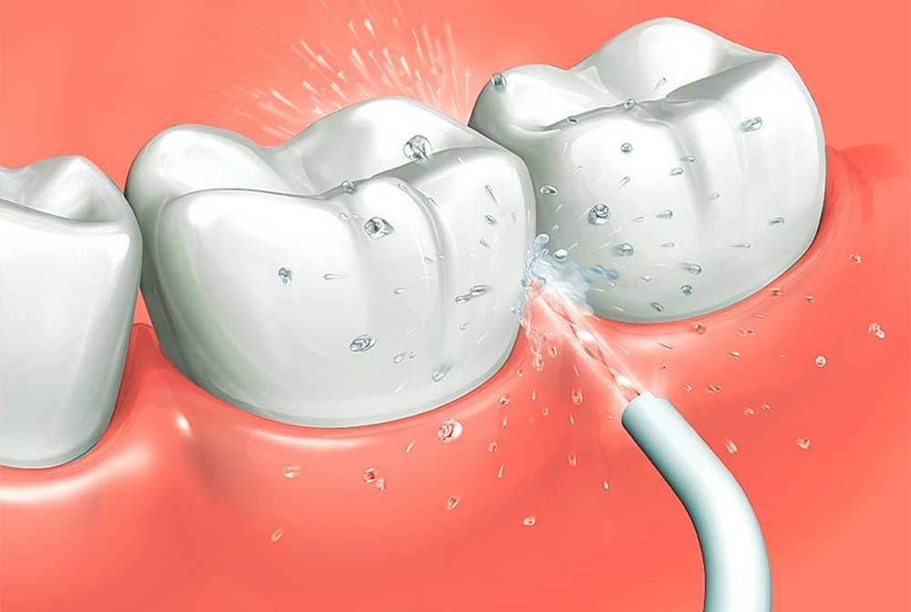 OralWave® Irrigador Bucal Eléctrico: Limpieza Profunda en Cualquier Lugar